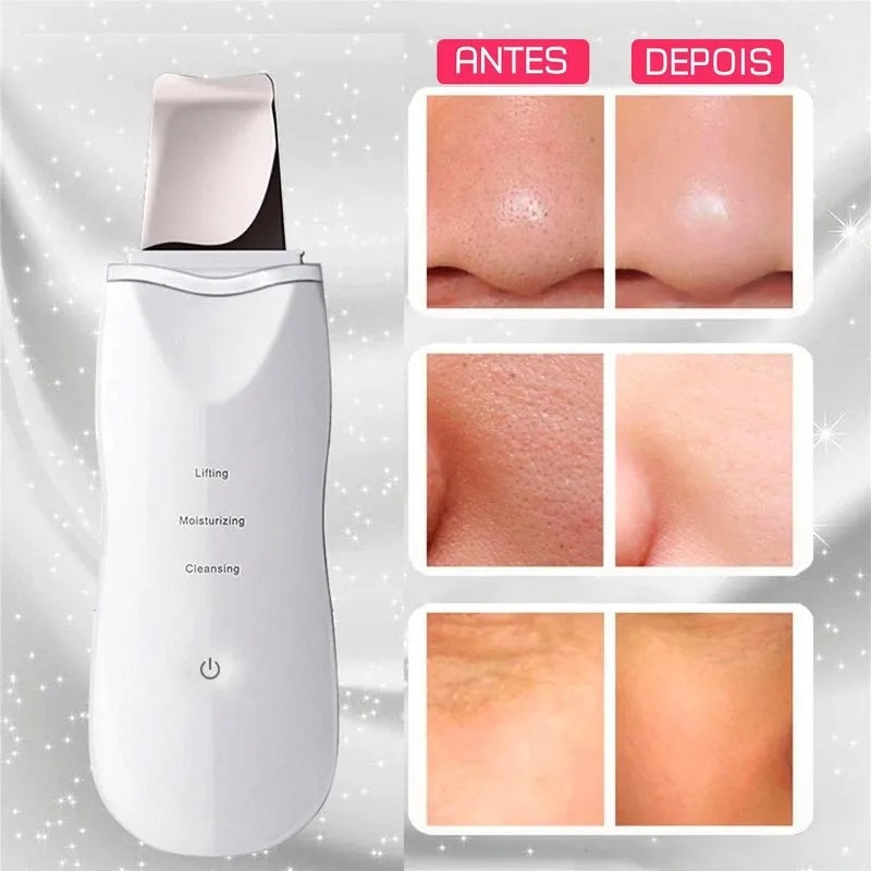 limpiador Facial Ultrasónico